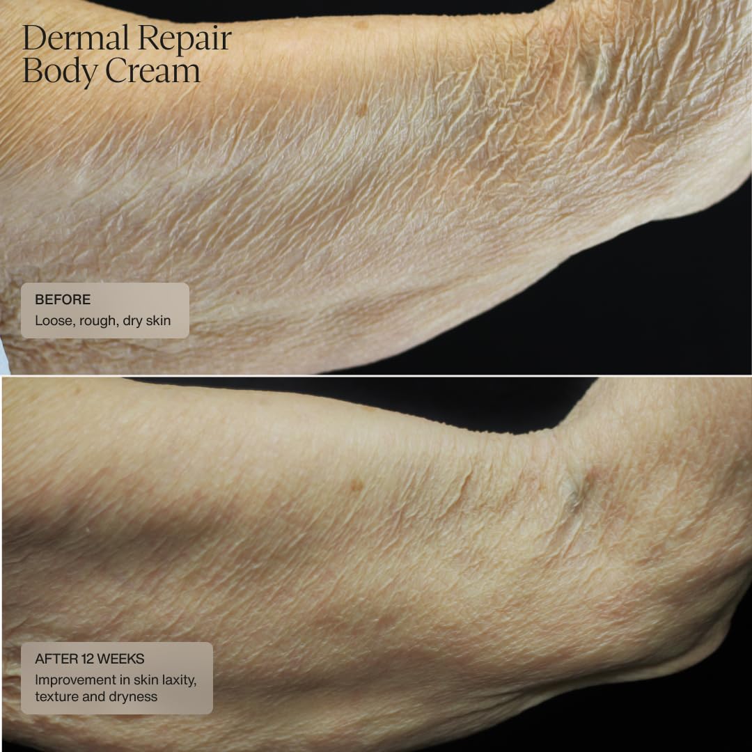 Sente Senté Dermal Repair Body Cream | Promotes FirmerLooking Skin, 8 Fl Oz Gallery Photo 3