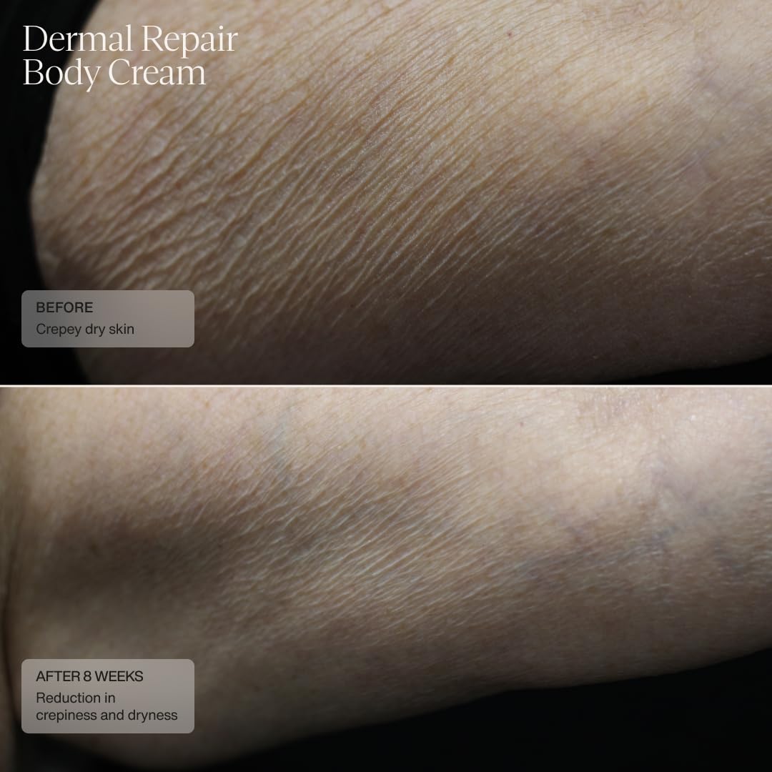 Sente Senté Dermal Repair Body Cream | Promotes FirmerLooking Skin, 8 Fl Oz Gallery Photo 4